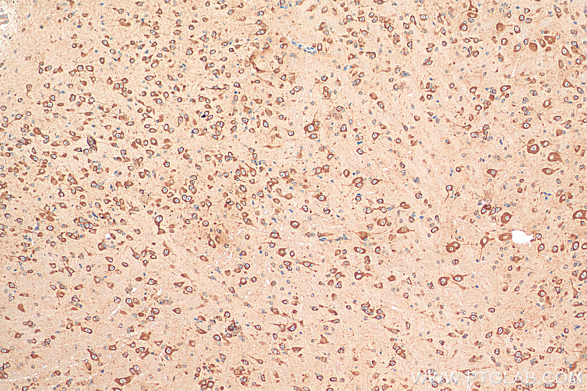 IHC staining of mouse brain using 21379-1-AP