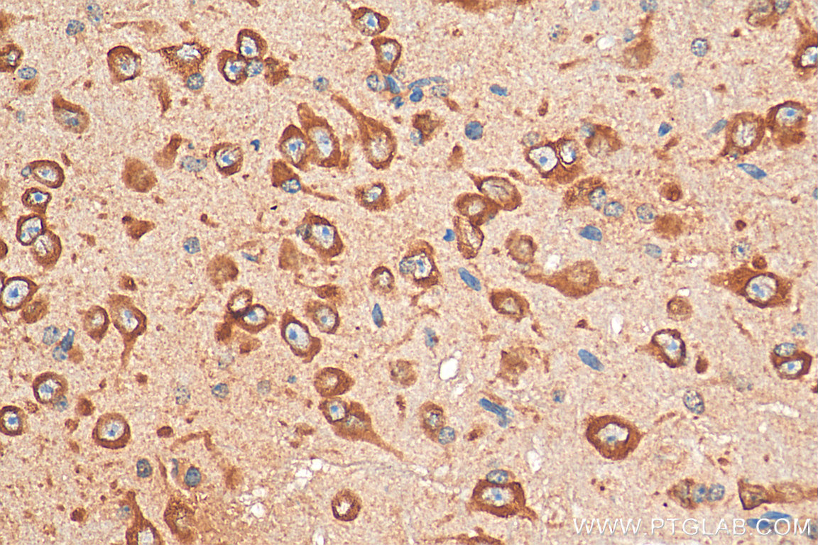 IHC staining of mouse brain using 21379-1-AP