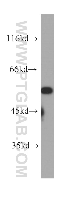 WB analysis of MCF-7 using 60220-1-Ig