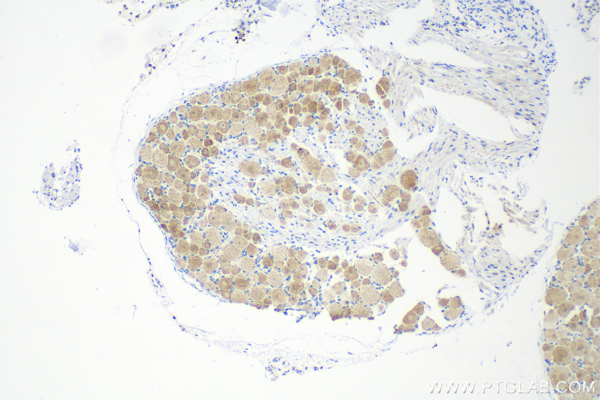 IHC staining of rat dorsal root ganglion using 82848-3-RR