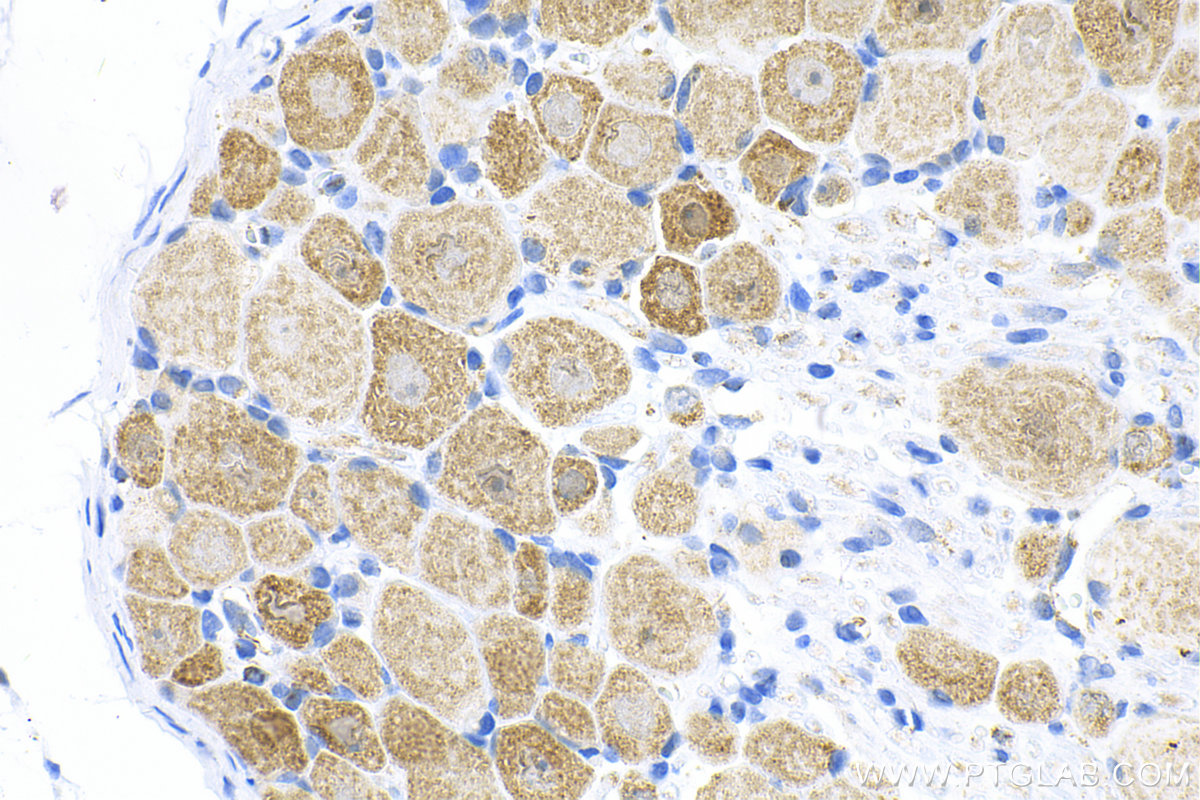 IHC staining of rat dorsal root ganglion using 82848-3-RR