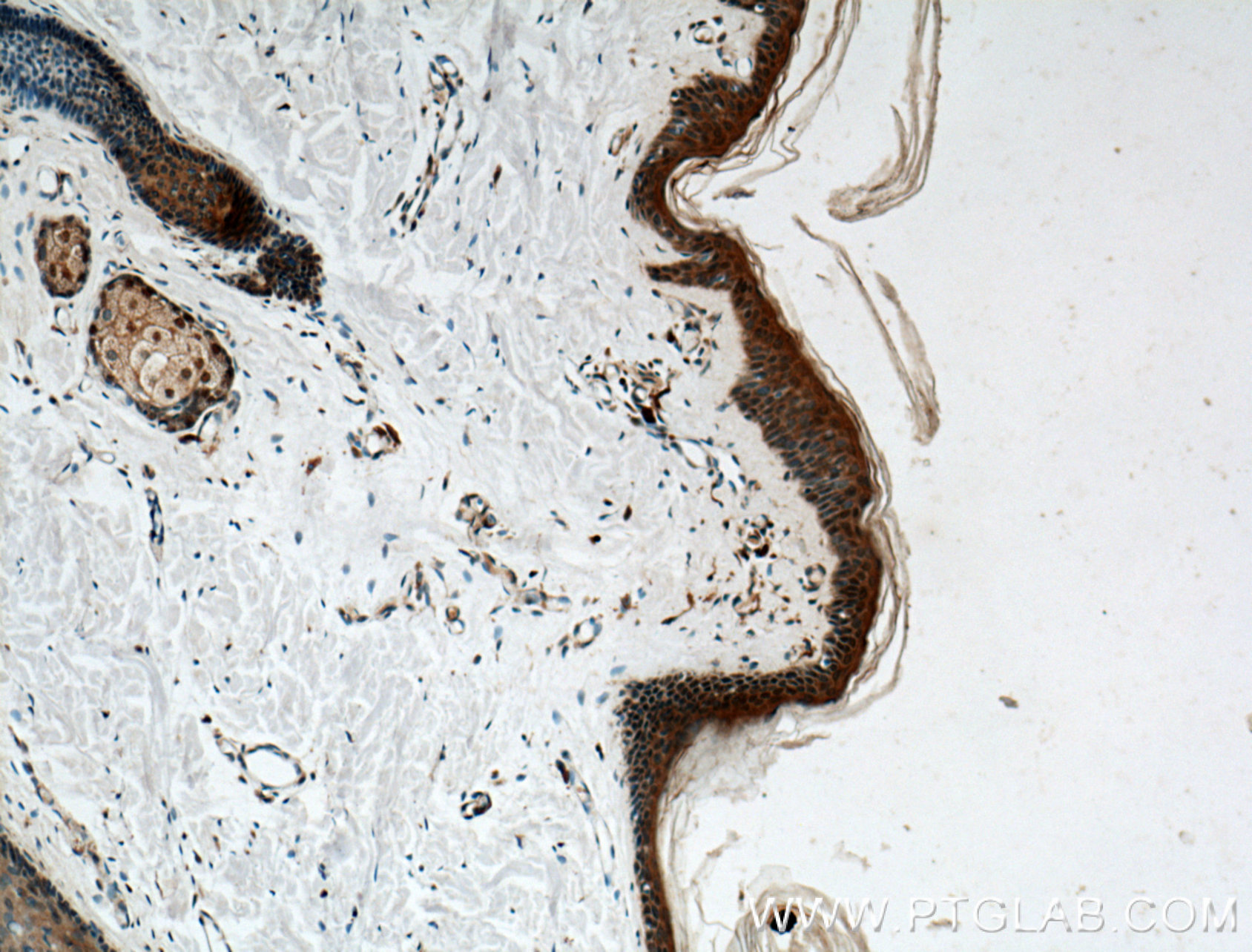 CHRNA9