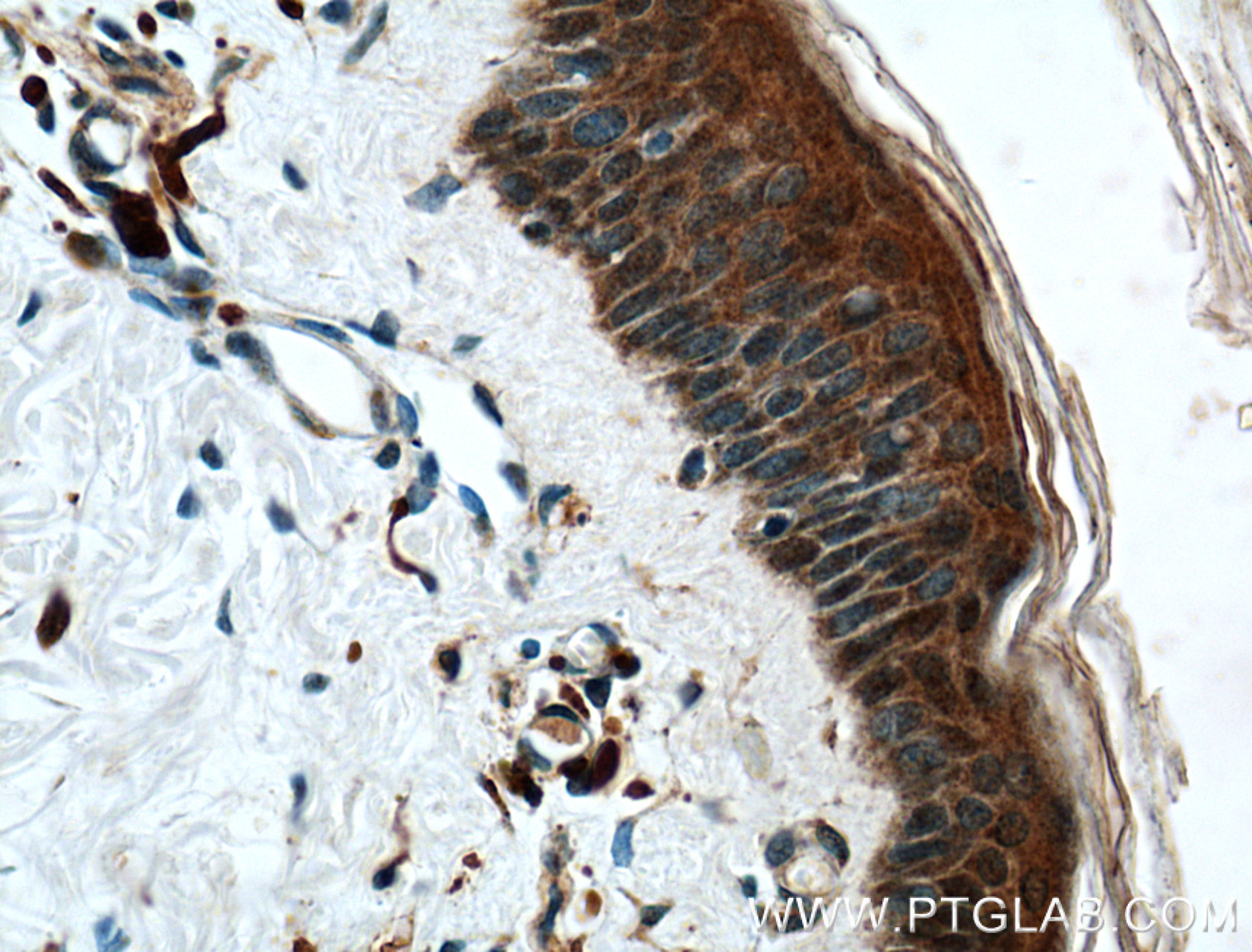 IHC staining of human skin using 26025-1-AP