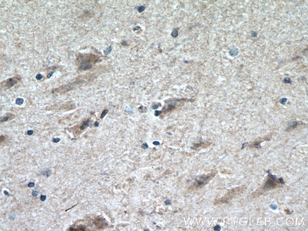 IHC staining of human brain using 17844-1-AP