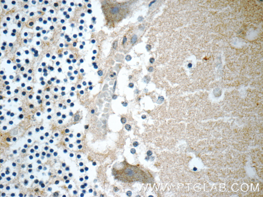 IHC staining of human cerebellum using 18037-1-AP