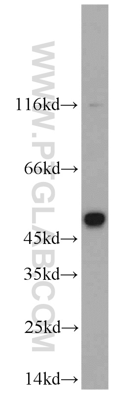 CHRNB4 Polyclonal antibody