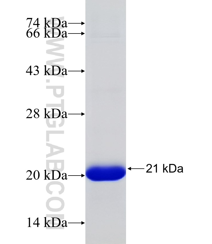 CHRNB4 fusion protein Ag31759 SDS-PAGE