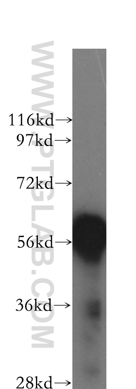 WB analysis of BxPC-3 using 12013-1-AP