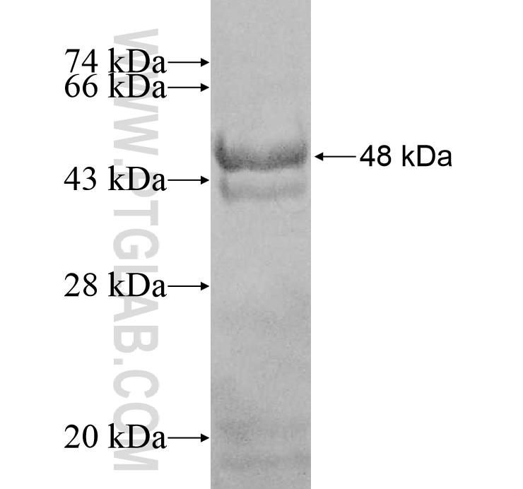 CHST11 fusion protein Ag8875 SDS-PAGE CHST11 fusion protein Ag8875 SDS-PAGE