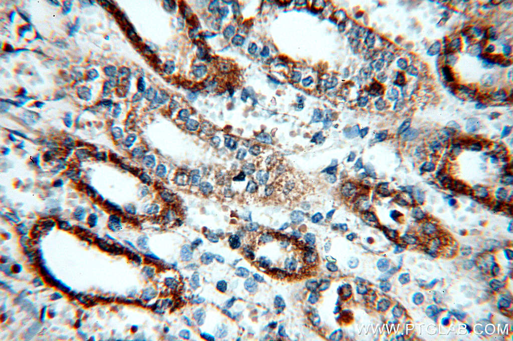 IHC staining of human kidney using 20141-1-AP