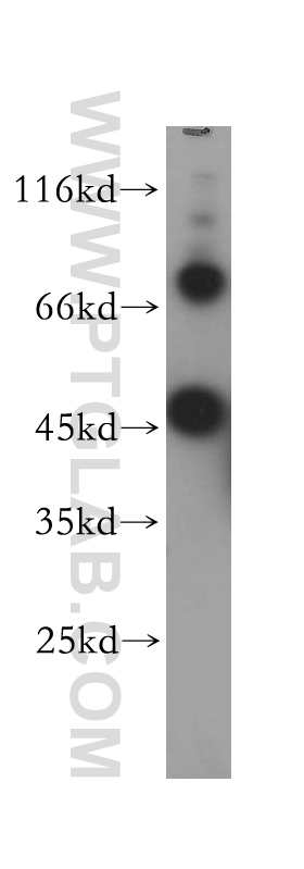 WB analysis of HEK-293 using 17749-1-AP