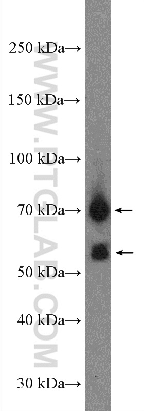 WB analysis of mouse brain using 14131-1-AP