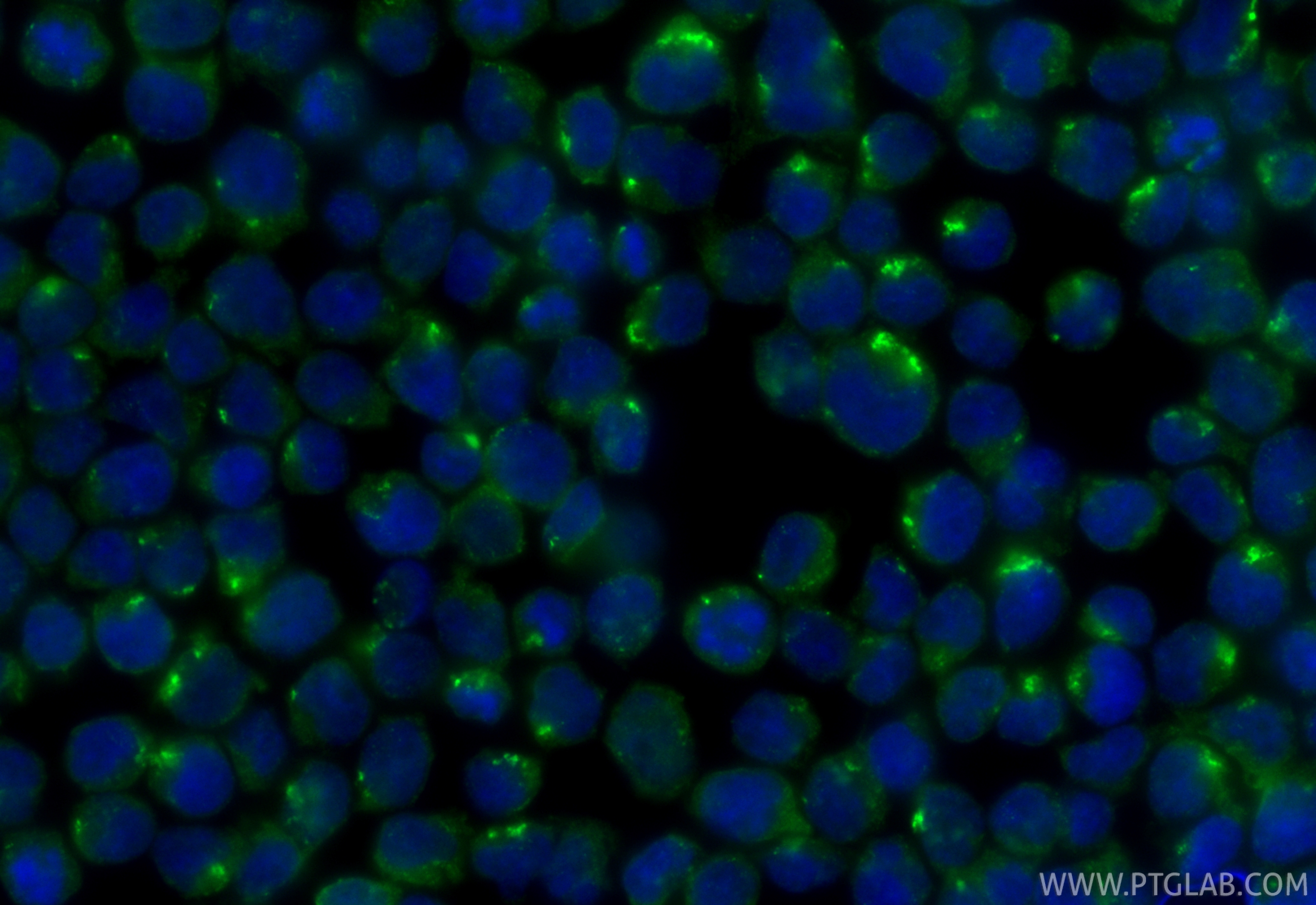 IF Staining of Jurkat using 14298-1-AP