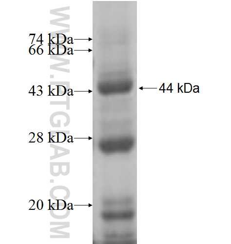 CHST15 fusion protein Ag5805 SDS-PAGE CHST15 fusion protein Ag5805 SDS-PAGE