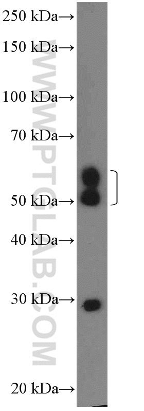 WB analysis of mouse brain using 26027-1-AP