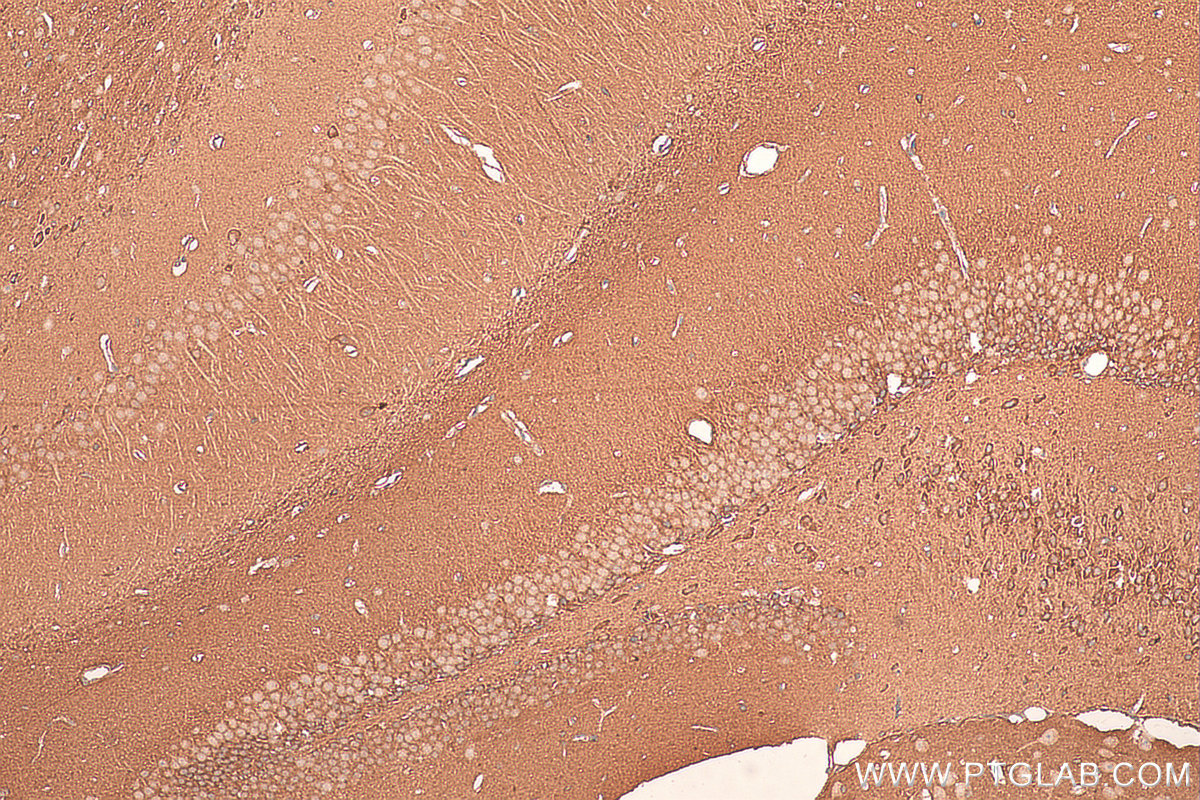 IHC staining of mouse brain using 18242-1-AP