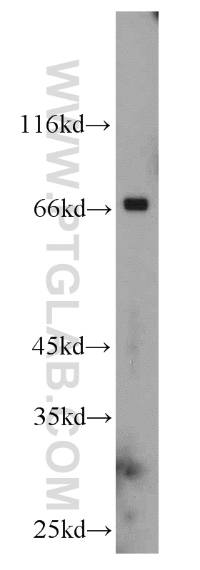 WB analysis of mouse heart using 18242-1-AP