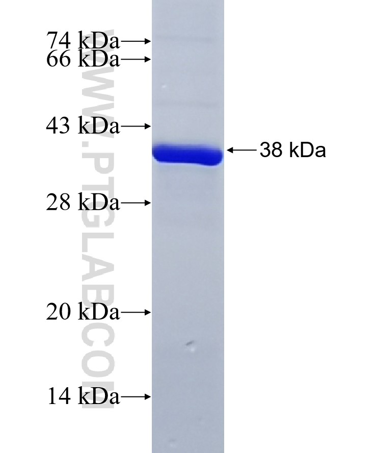 CHST4 fusion protein Ag3987 SDS-PAGE