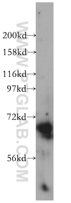 WB analysis of mouse spleen using 14420-1-AP