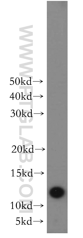 WB analysis of mouse skin using 12247-1-AP