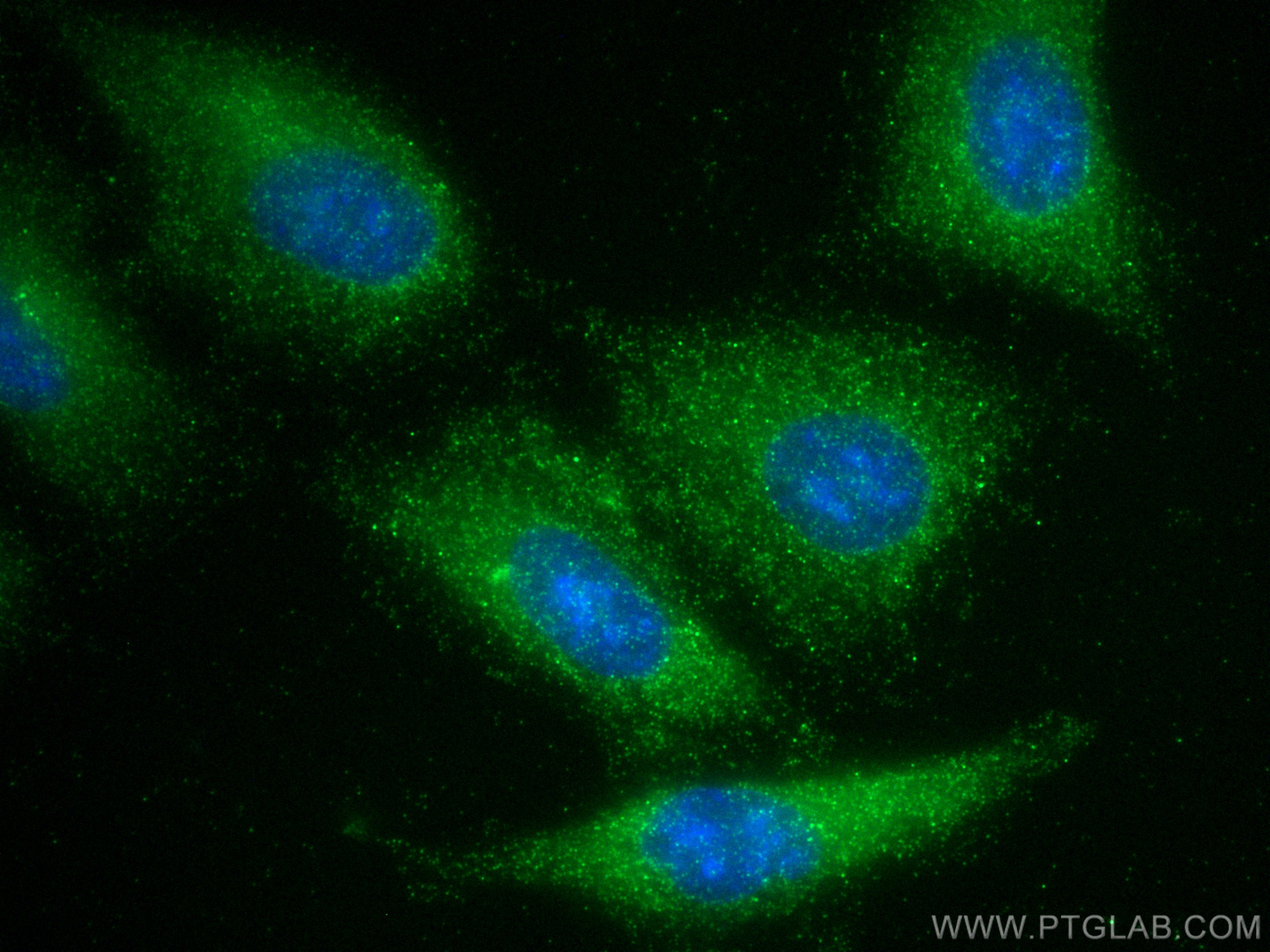 IF Staining of A549 using 11823-1-AP