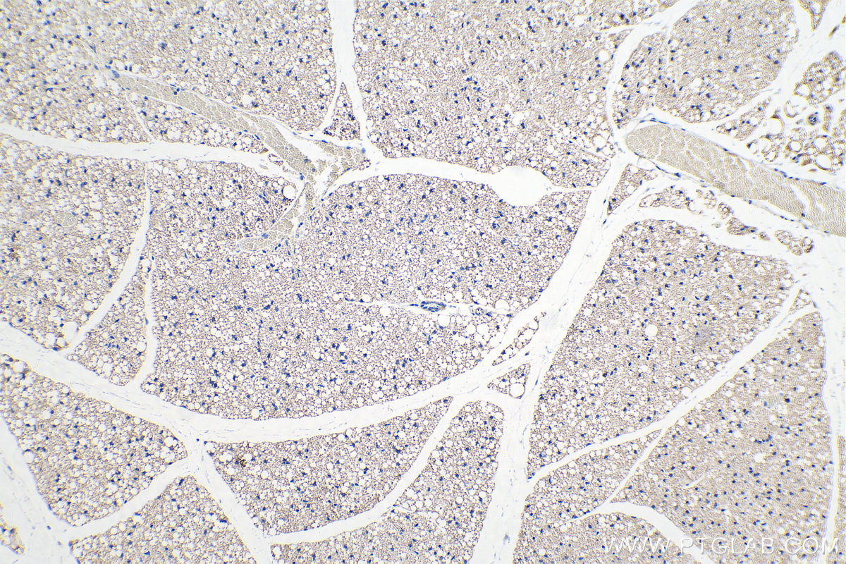 IHC staining of mouse brown adipose using 13170-1-AP