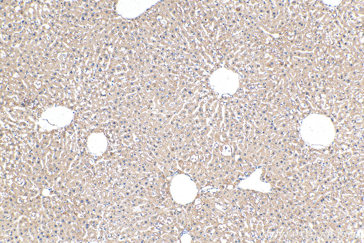 IHC staining of mouse liver using 27600-1-AP