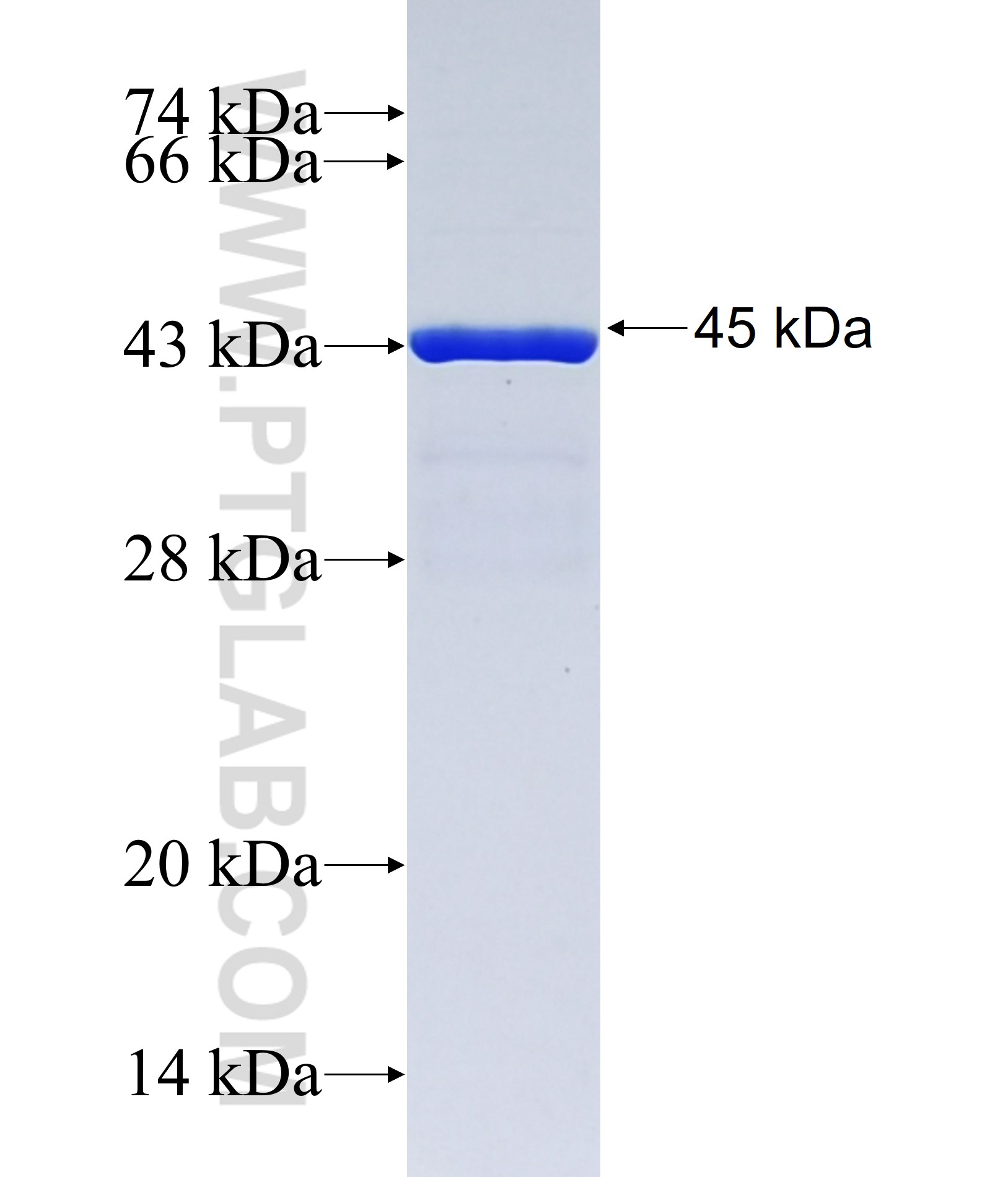 CILP2 fusion protein Ag38067 SDS-PAGE CILP2 fusion protein Ag38067 SDS-PAGE