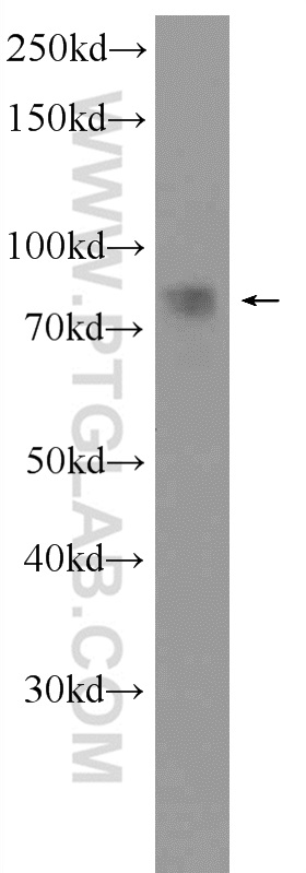 CIN85 Polyclonal antibody