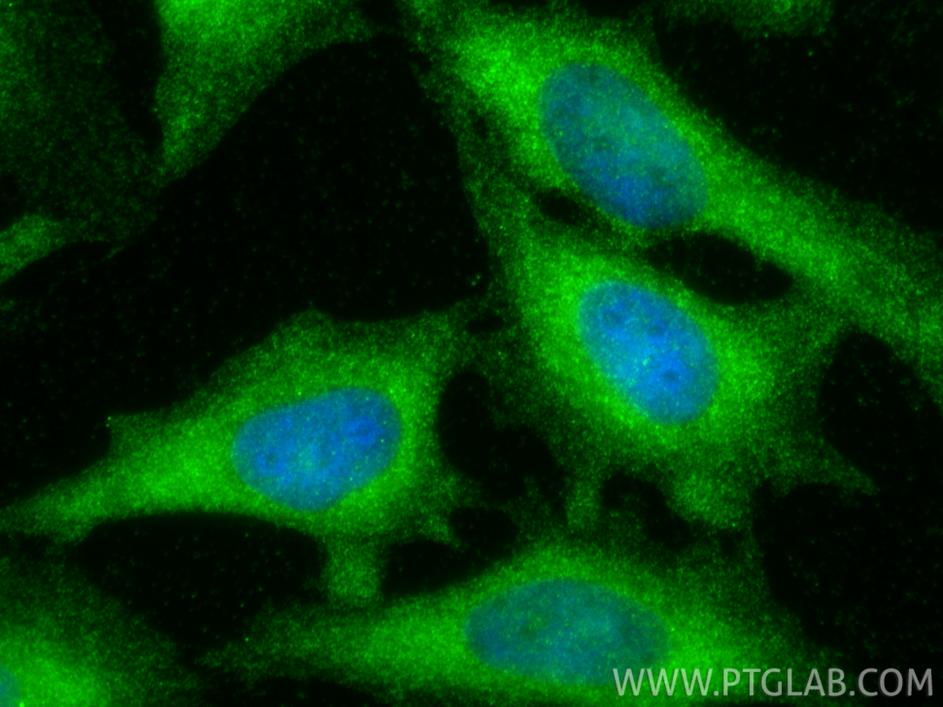 IF Staining of HeLa using 23199-1-AP IF Staining of HeLa using 23199-1-AP