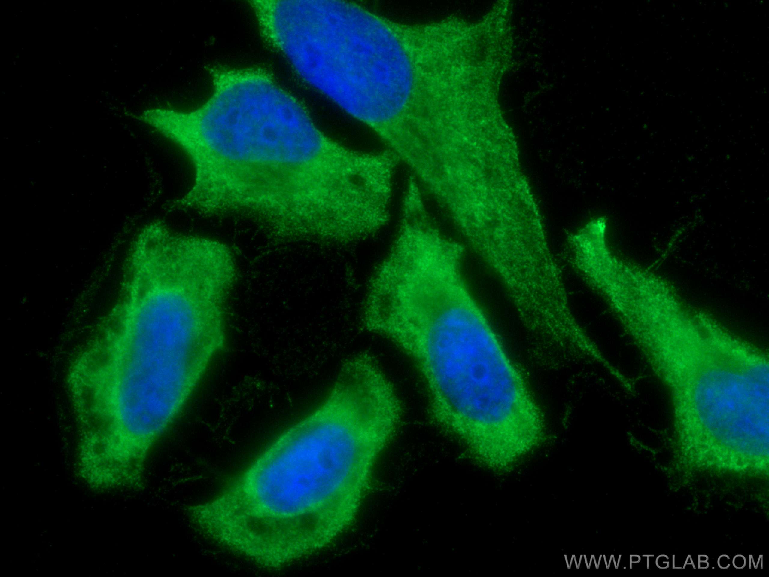 IF Staining of HeLa using CL488-67843