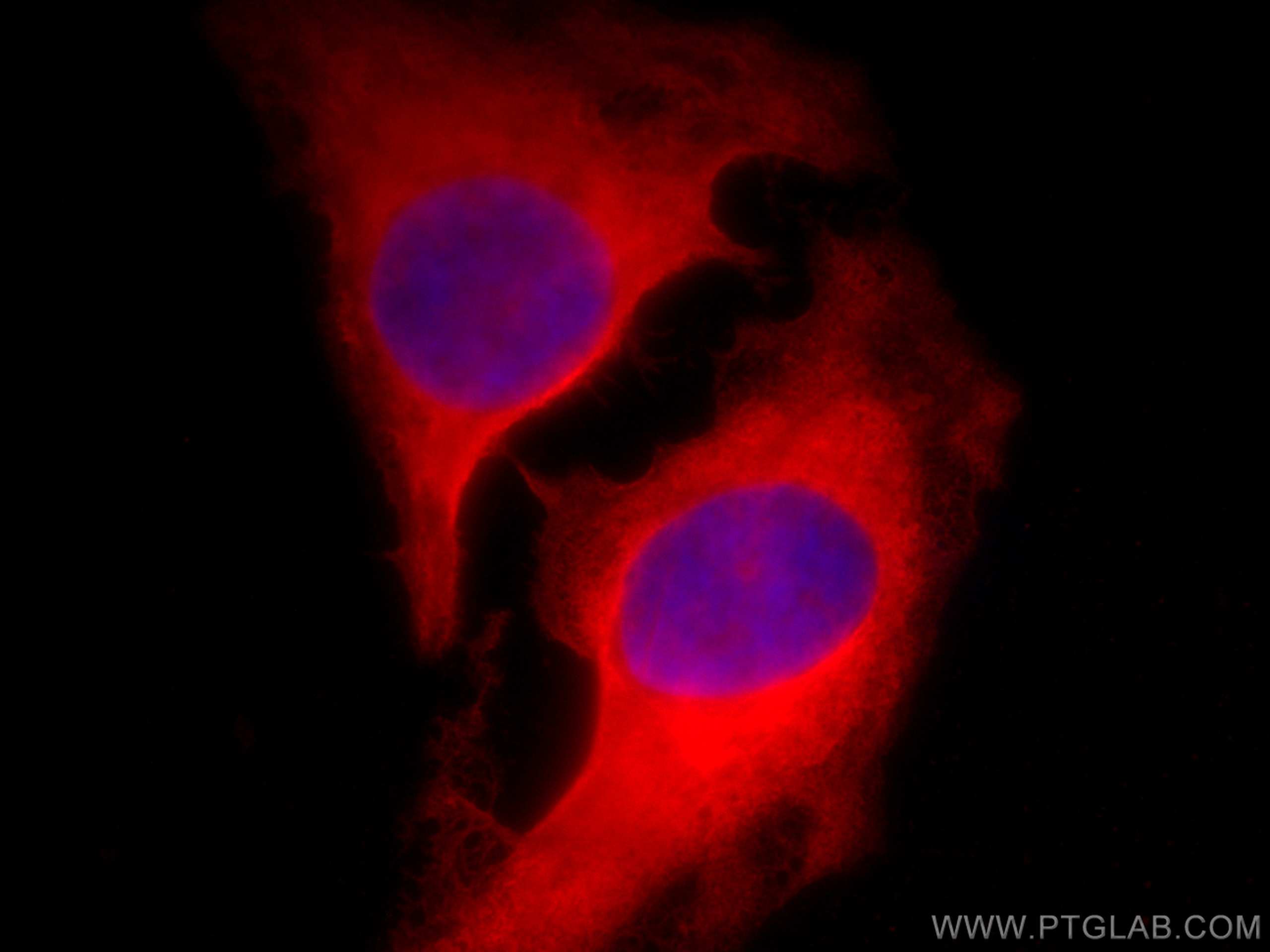 IF Staining of HeLa using CL594-67843