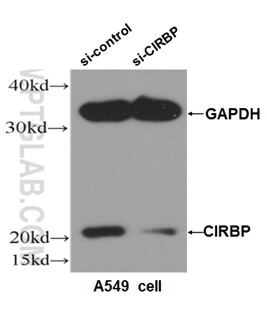 WB analysis of A549 cells using 10209-2-AP