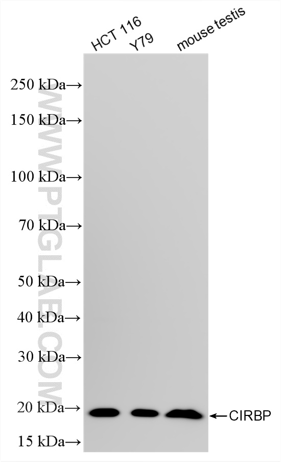 WB analysis using 88400-2-RR (same clone as 88400-2-PBS) WB analysis using 88400-2-RR (same clone as 88400-2-PBS)