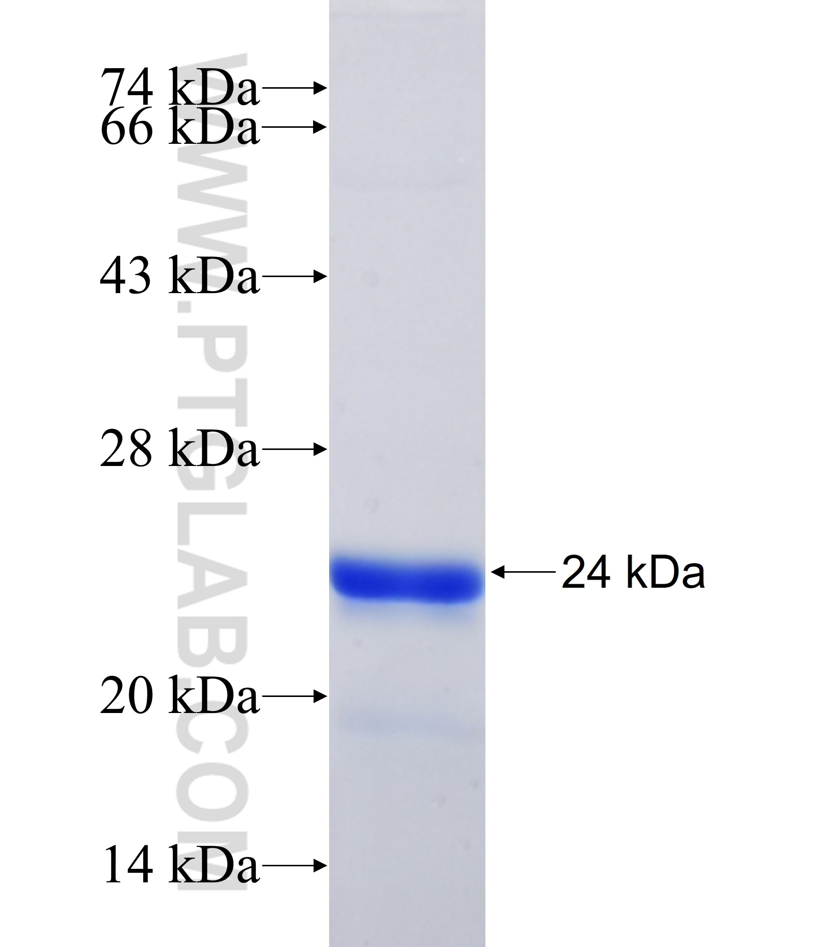CIRBP fusion protein Ag16702 SDS-PAGE CIRBP fusion protein Ag16702 SDS-PAGE