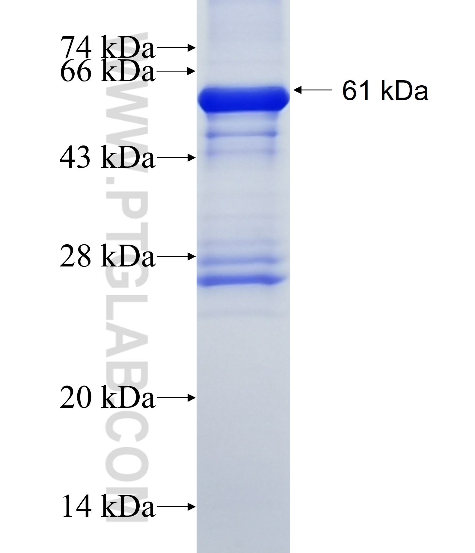 CIRH1A fusion protein Ag1494 SDS-PAGE