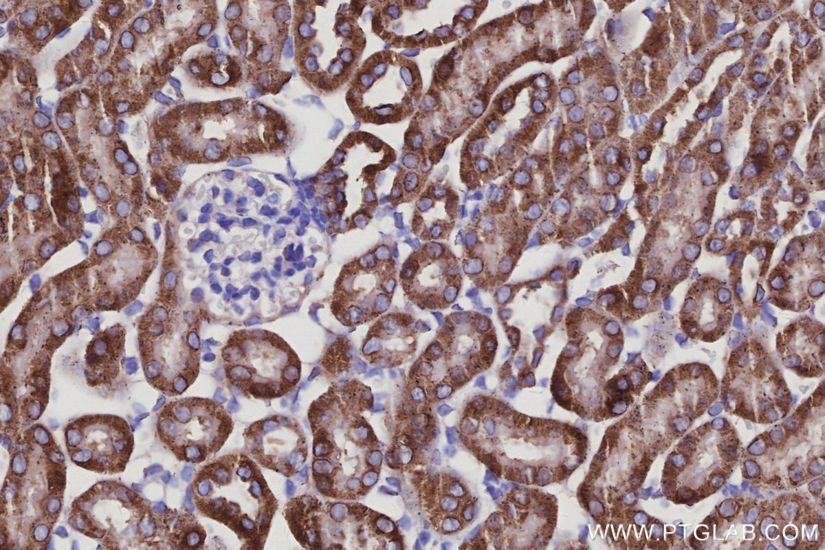 IHC staining of mouse kidney using 68030-1-Ig