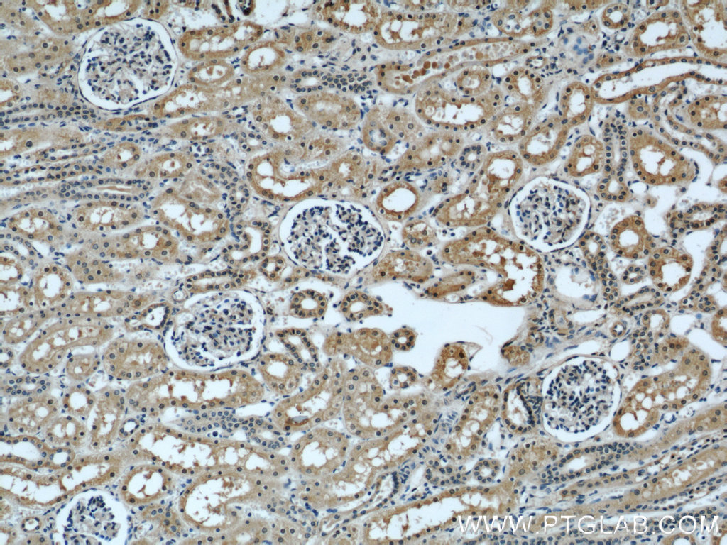 IHC staining of human kidney using 66082-1-Ig