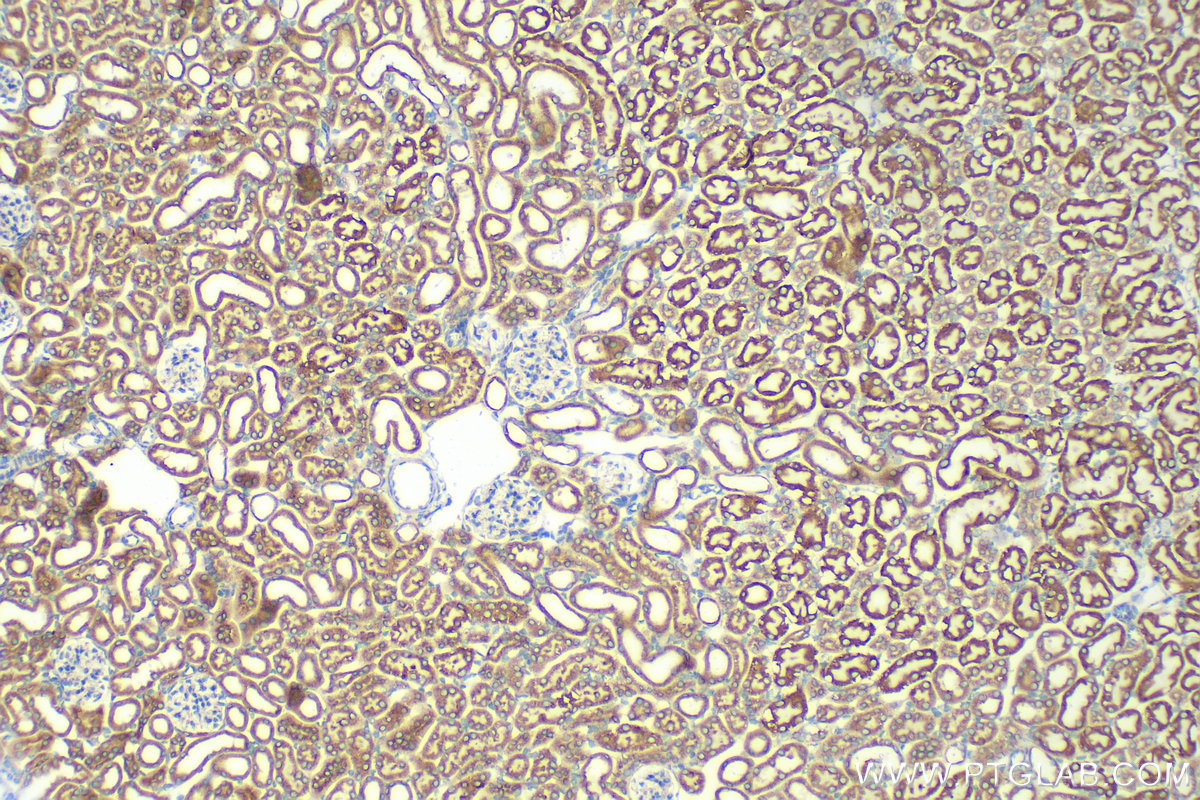 IHC staining of mouse kidney using 82802-10-RR (same clone as 82802-10-PBS)