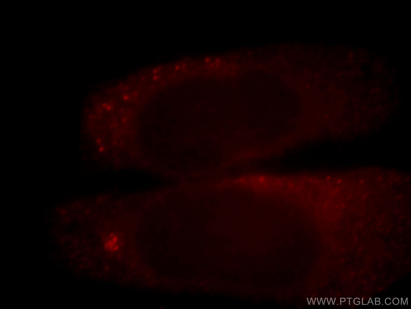 IF Staining of HepG2 using 20033-1-AP