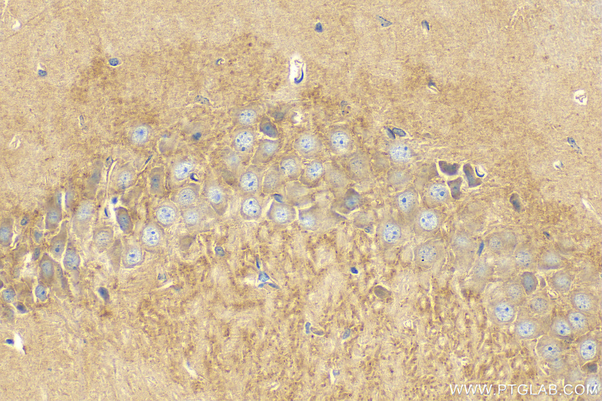 IHC staining of mouse brain using 20033-1-AP