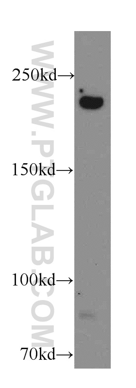 WB analysis of A431 using 20033-1-AP