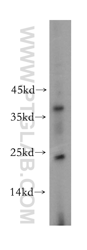 WB analysis of SH-SY5Y using 15021-1-AP