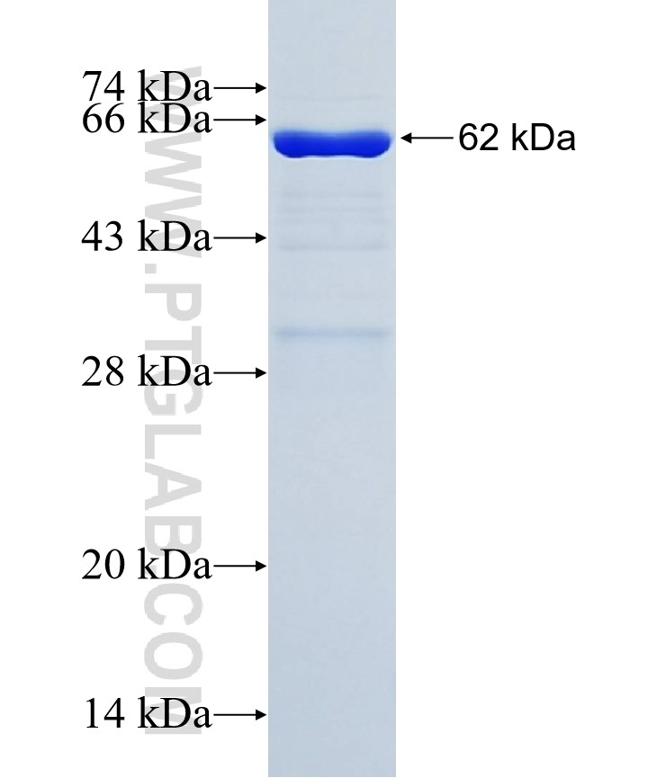 CK19 fusion protein Ag1085 SDS-PAGE