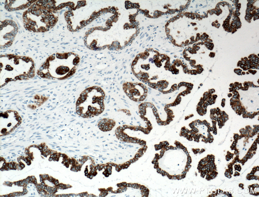 Cytokeratin 7