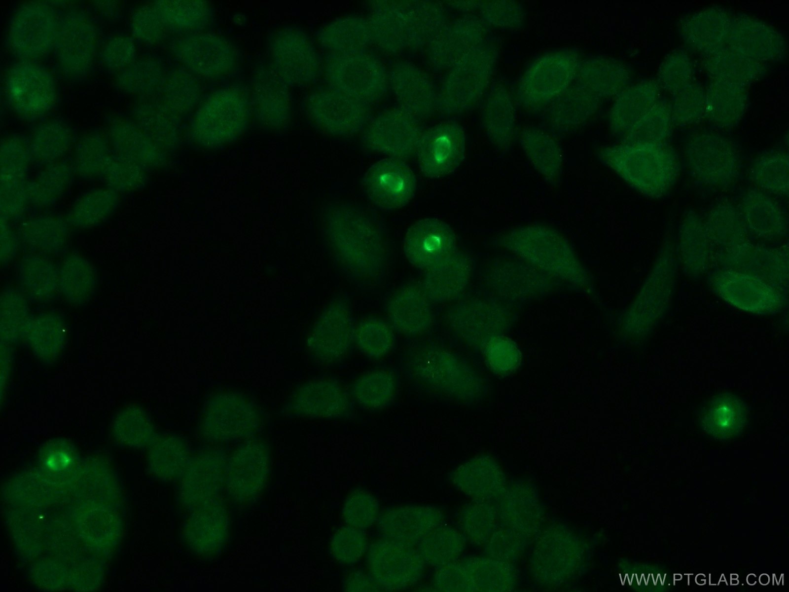 IF Staining of HeLa using 25486-1-AP