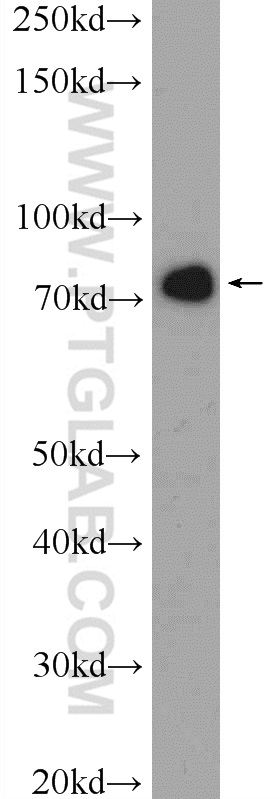 WB analysis of HeLa using 25486-1-AP