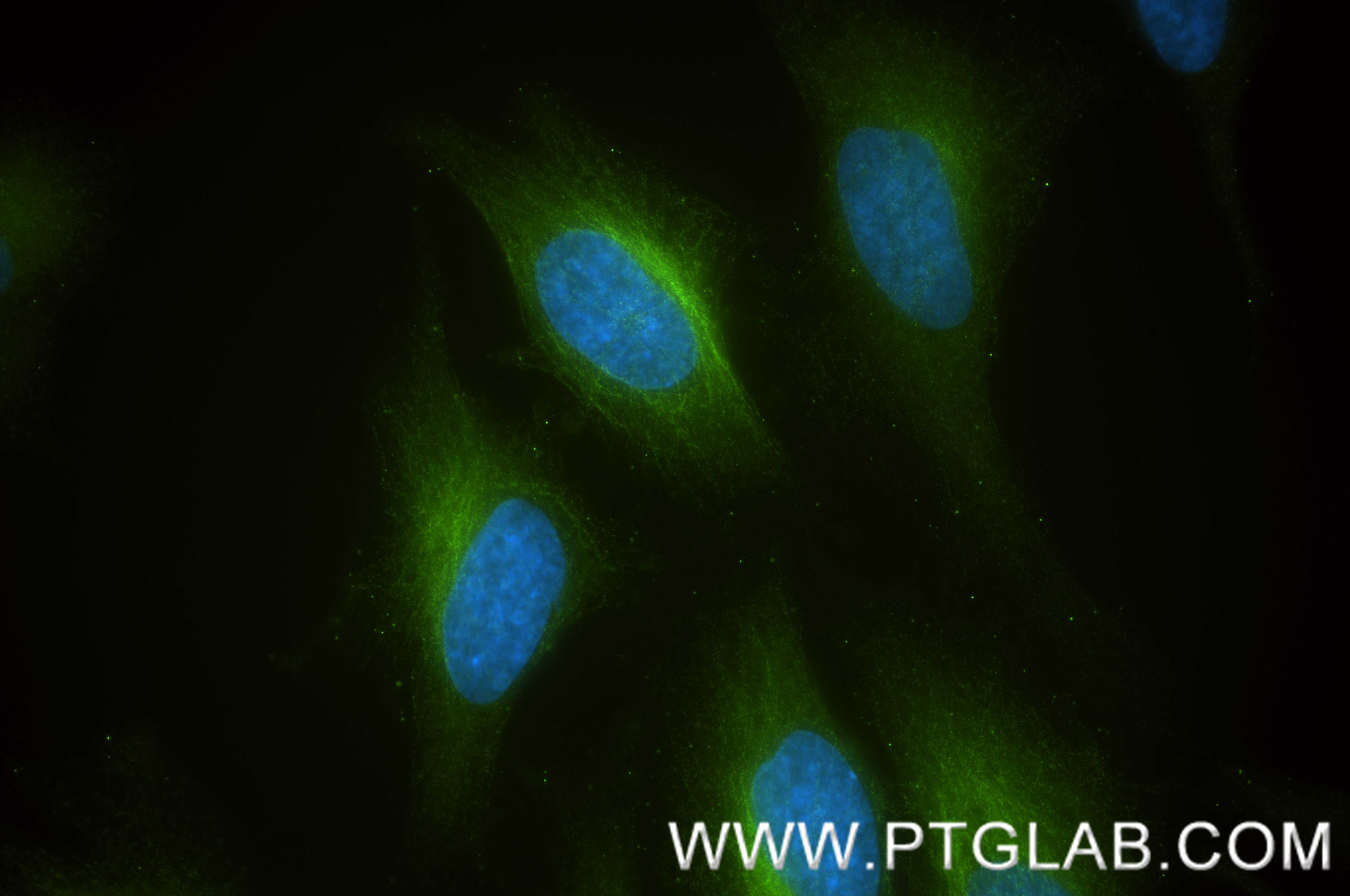 IF Staining of HeLa using 86689-1-RR IF Staining of HeLa using 86689-1-RR