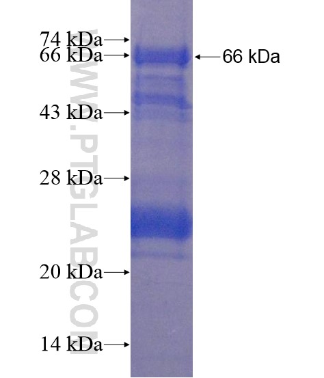 CKAP2 fusion protein Ag21901 SDS-PAGE