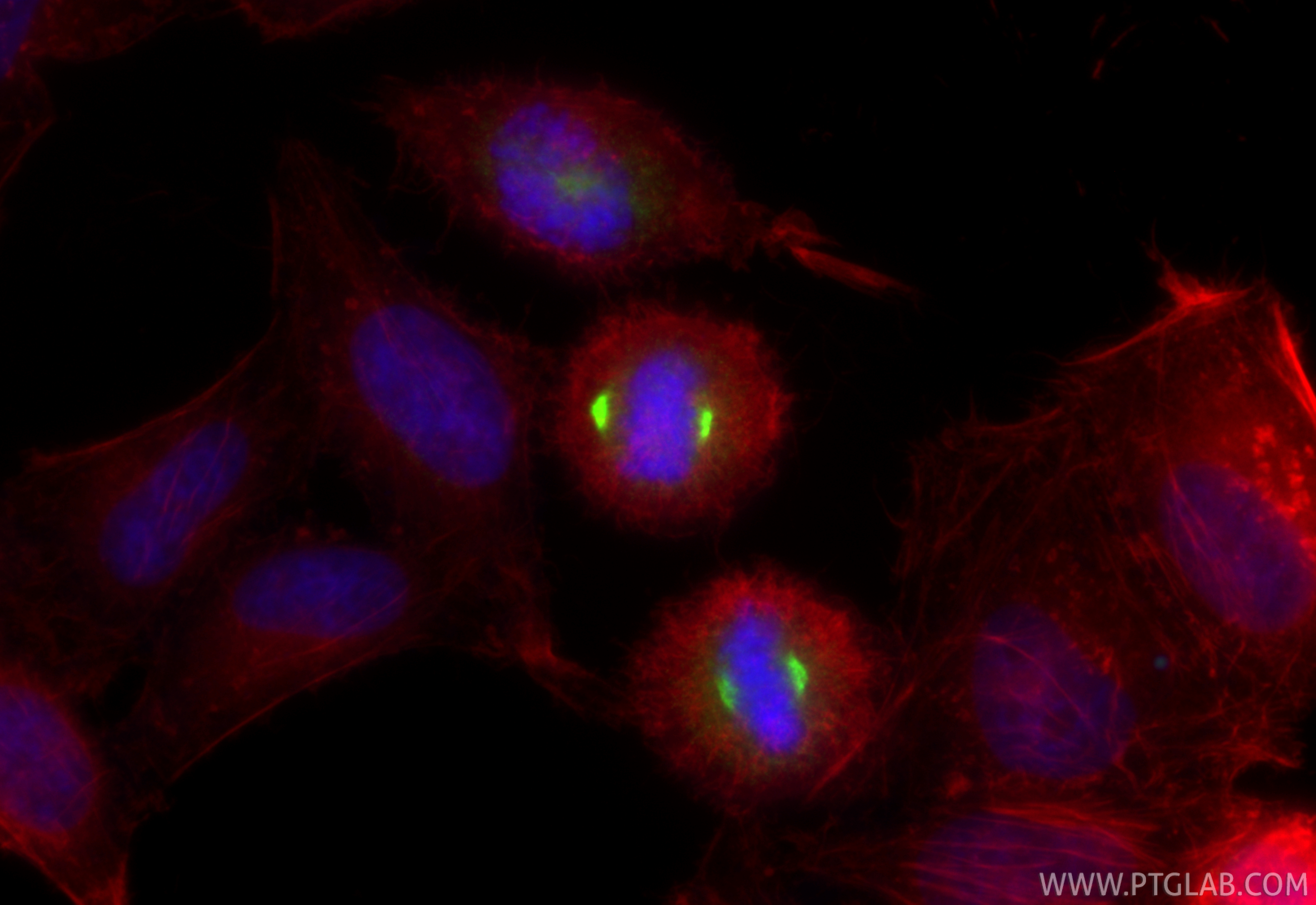 IF Staining of HepG2 using 17143-1-AP